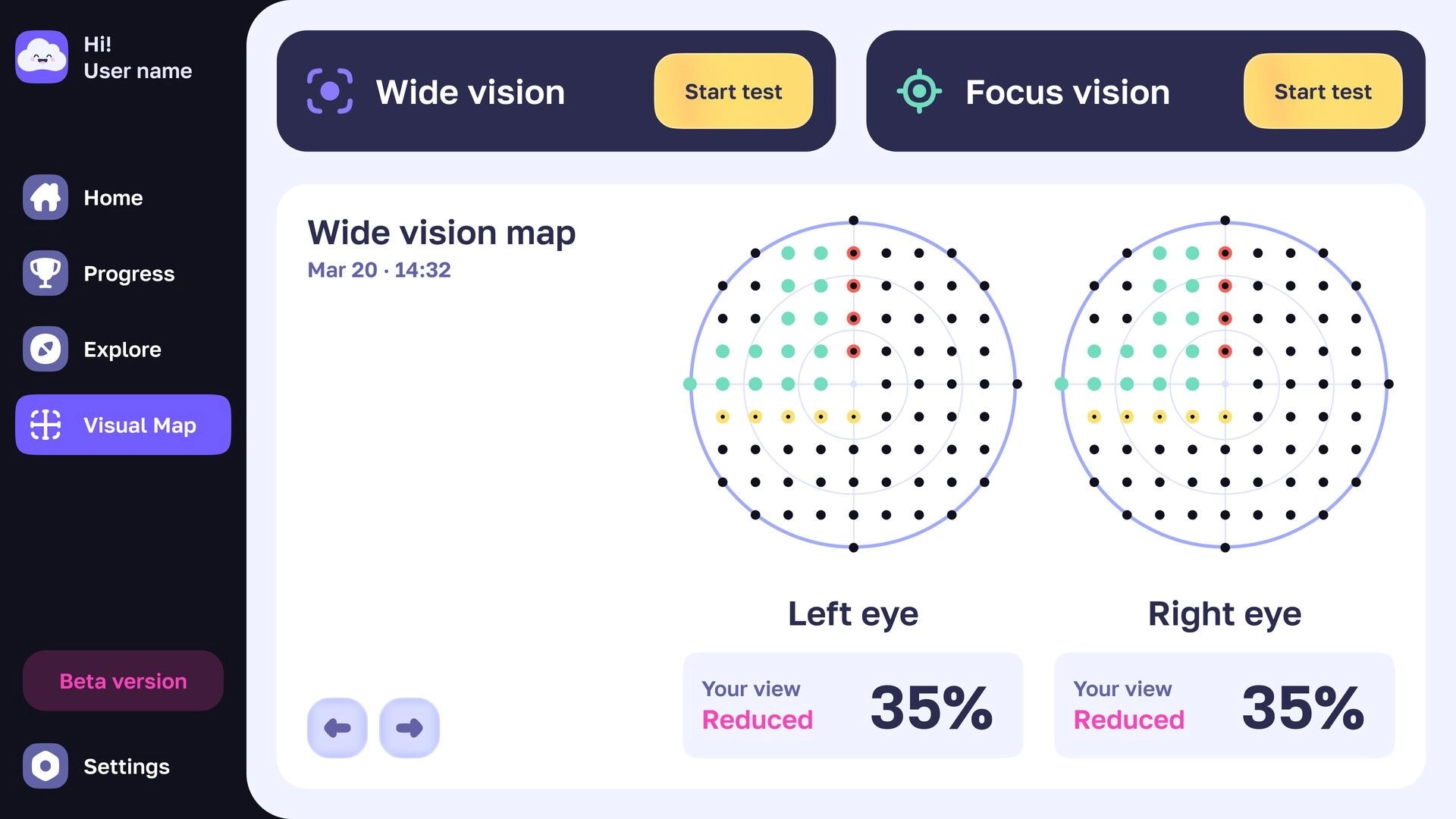 Catch the Light: Wide vision map results with left/right eye dot charts and 35% reduced view UI.
