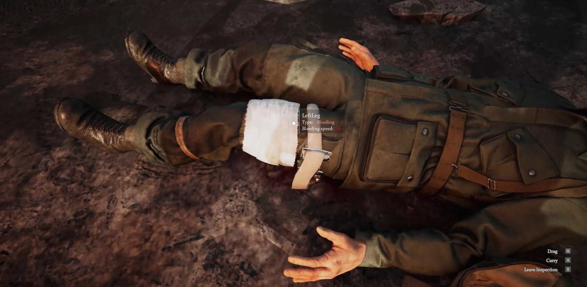 Medic: Inspecting wounded soldier's left leg with bleeding info, options to drag or carry displayed