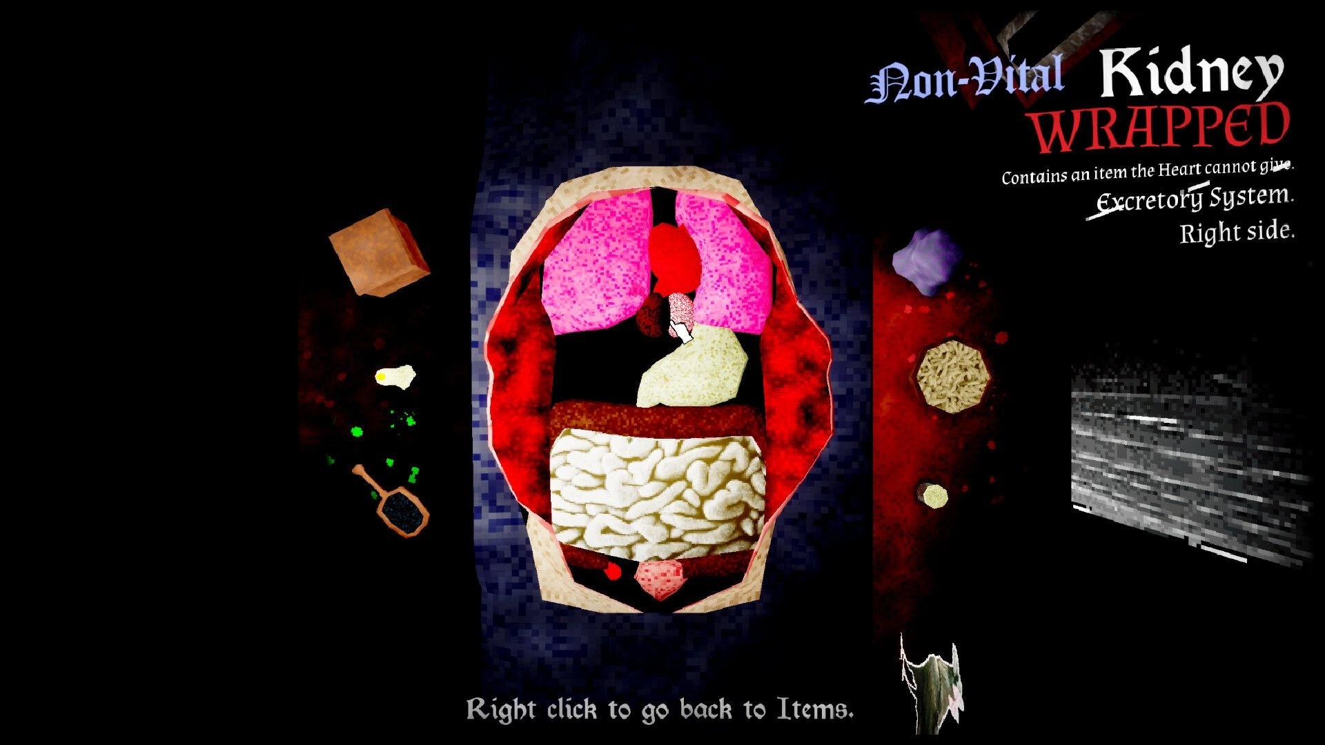 Organ Failure: Organ inspection screen highlighting a wrapped right kidney over an open torso table.