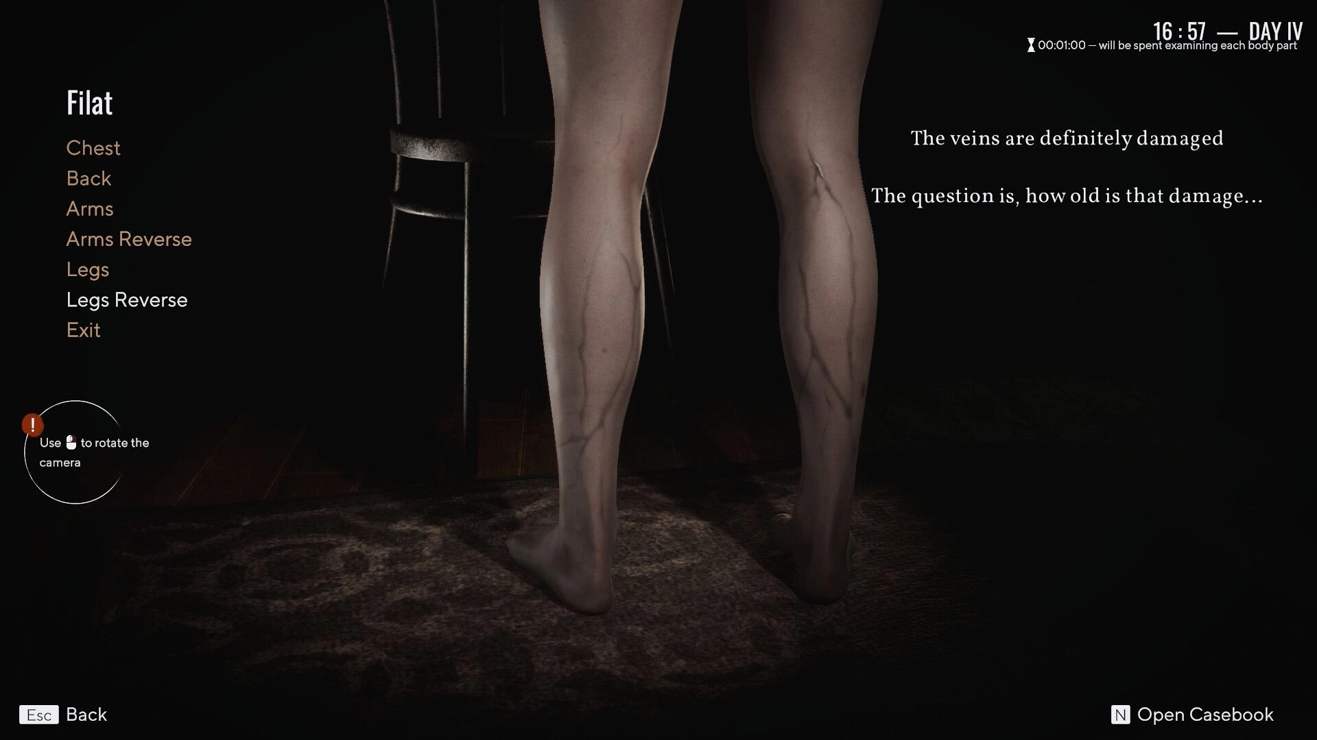 Pathologic 3: Examining damaged veins on patient's legs in a dimly lit room with menu options displayed