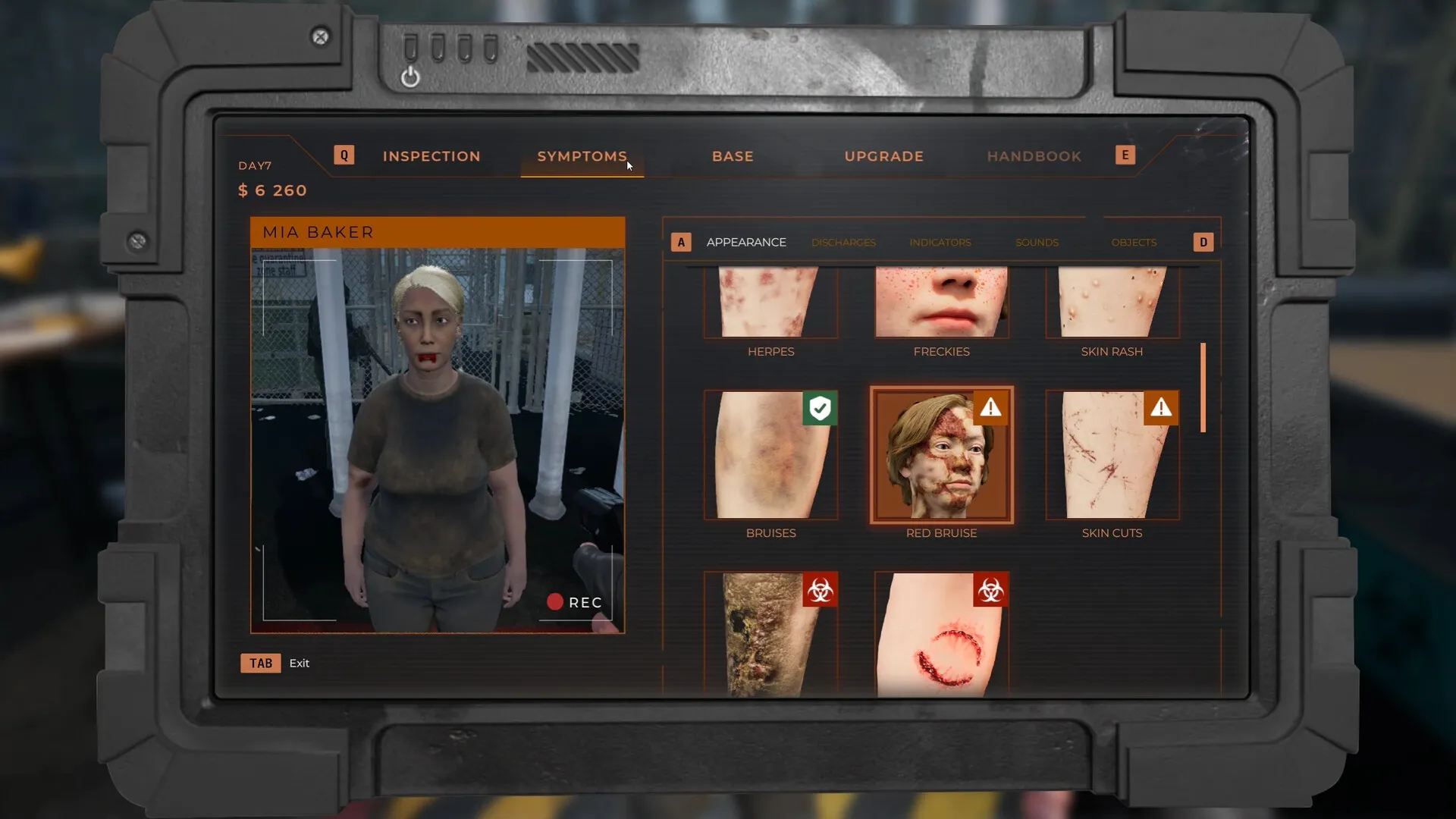 Quarantine Zone: Inspection screen with Mia Baker's symptoms including bruises, skin cuts, and red bruise