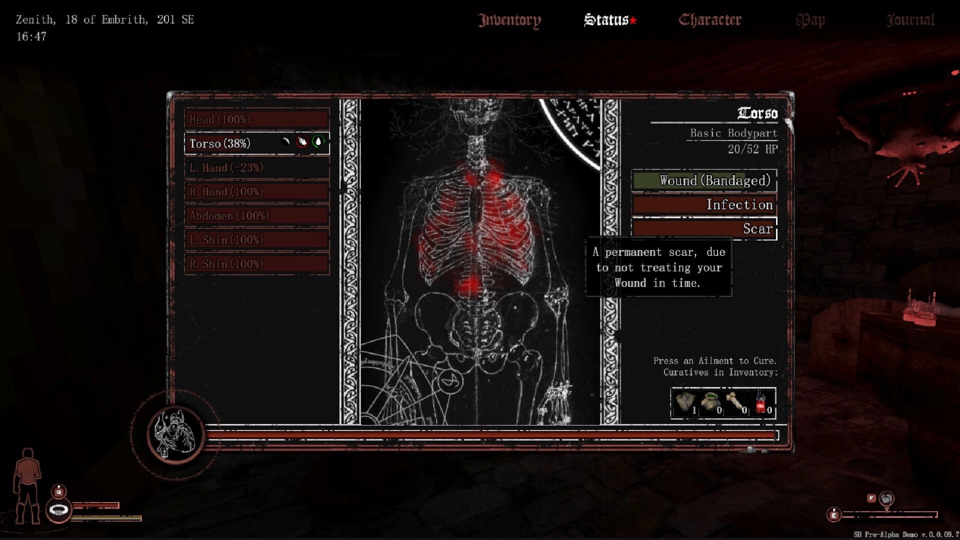 Sword Hero: Character status screen displaying torso injury details and healing options in a dark room.