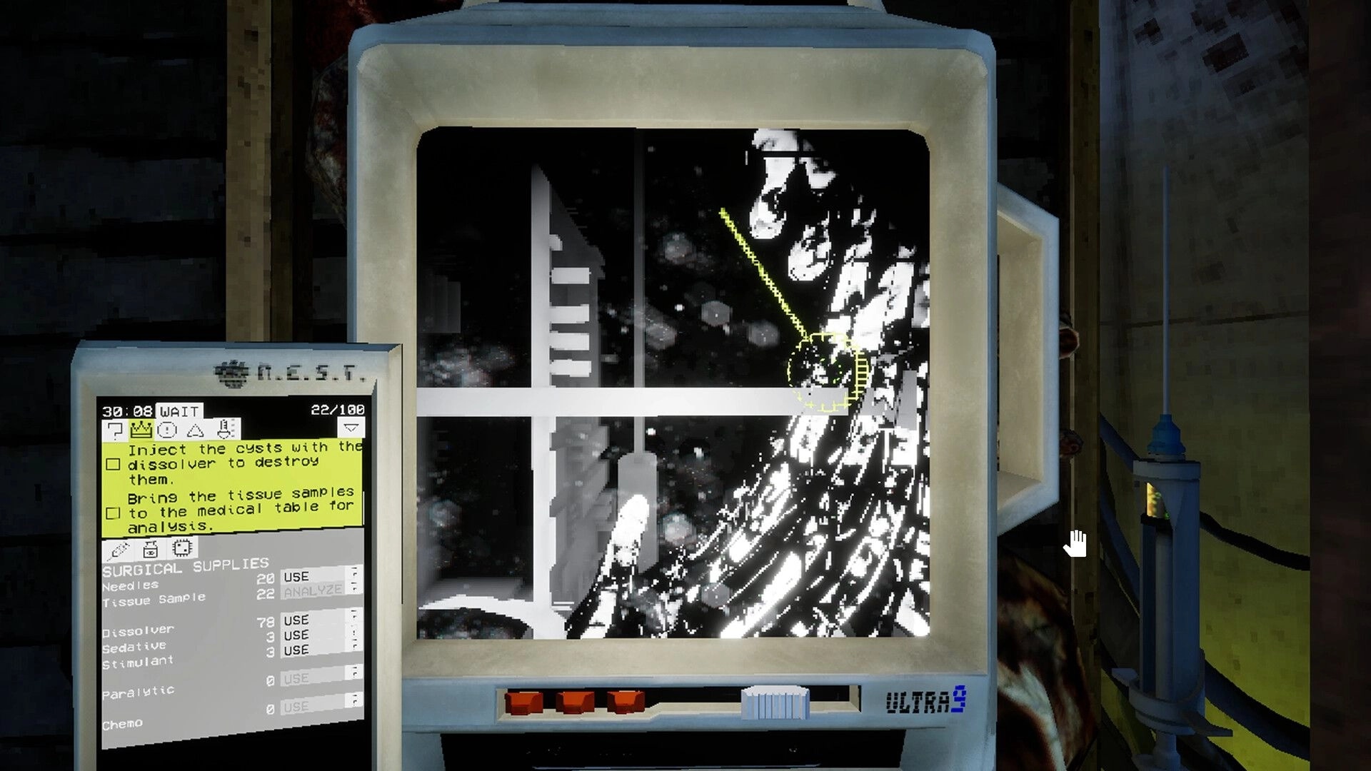 Ultrasound: Diagnostic screen displays infected tissue with task list on left in a darkened space freighter