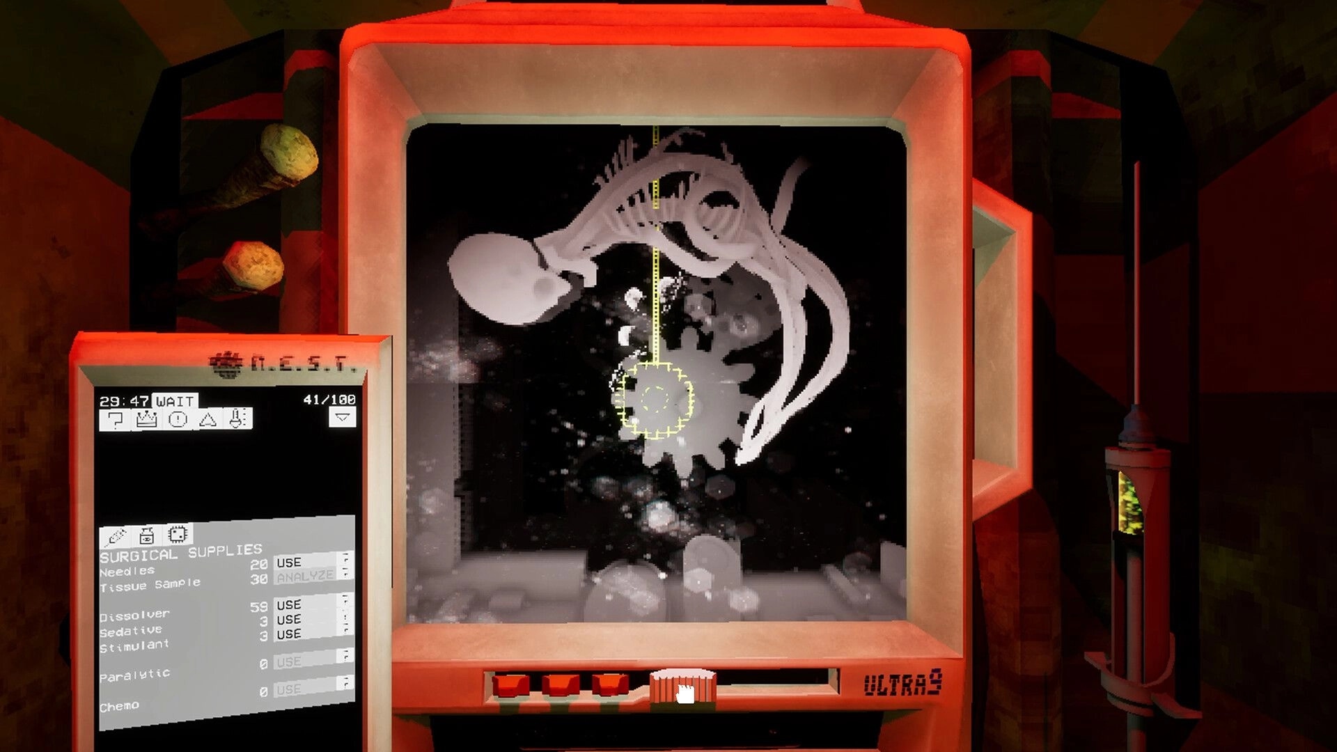 Ultrasound: Ultrasound machine displays skeletal structure; surgical supplies menu visible on screen